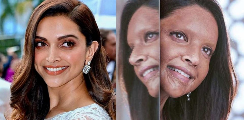 DeepikaAcidVictims